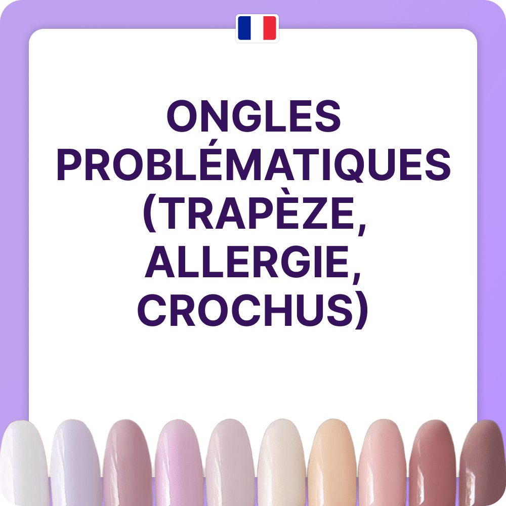 ONGLES PROBLÉMATIQUES